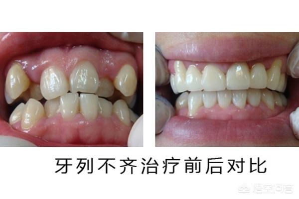 曲靖最新24小时牙医在线咨询方法分析(最方便真实的曲靖有没有24小时牙医方法)