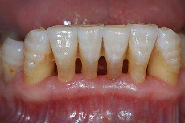 曲靖最新24小时牙医在线咨询方法分析(最方便真实的曲靖有没有24小时牙医方法)